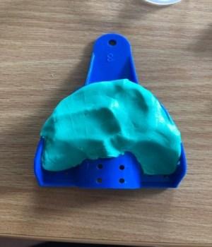 Fill impression tray with putty